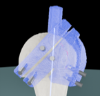 RTPtial PSI 1